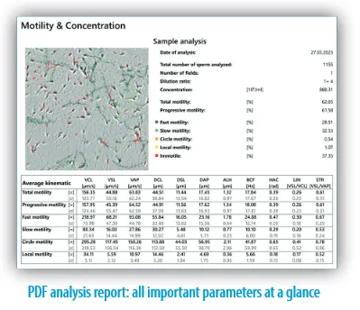 AndroScope®, For Mobile Semen Analysis Unit, Each